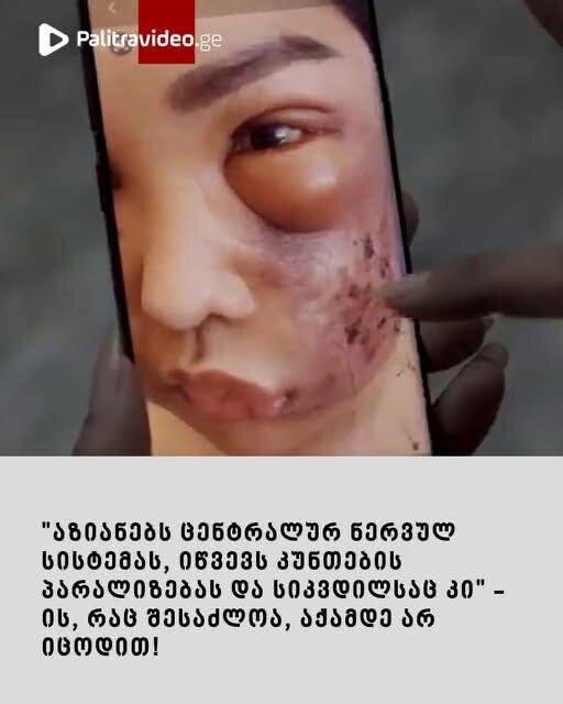 “აზიანებს ცენტრალურ ნერვულ სისტემას, იწვევს კუნთების პარალიზებას და სიკვდილსაც კი” – ის, რაც შესაძლოა, აქამდე არ იცოდით!